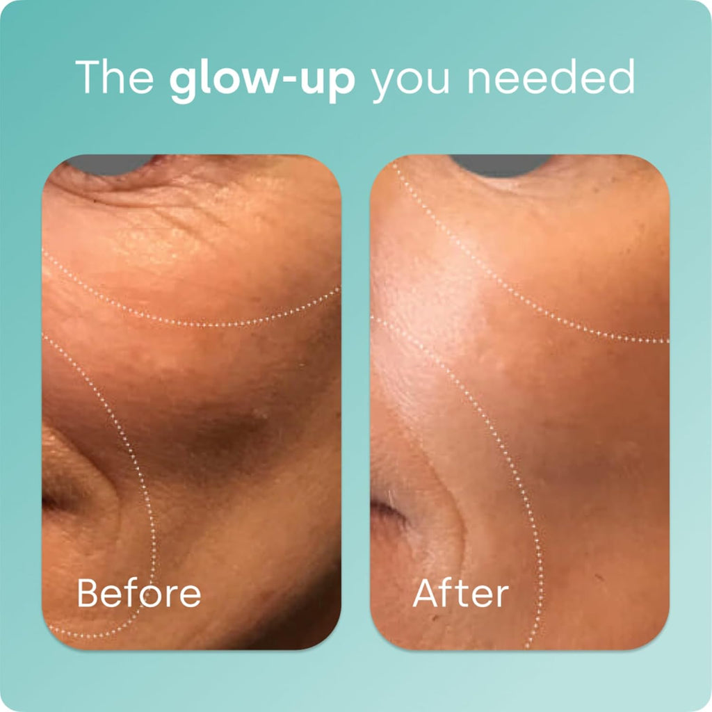 Suplemento de Colágeno Biosil - Belleza Natural y Radiante - 5