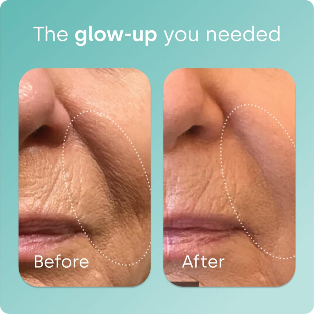 Suplemento Biosil Colágeno Ultra Efectivo - 60 Días - 5